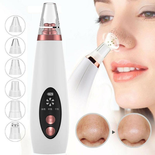 Limpiador de poros y puntos negros, limpiador de nariz, botón para eliminar acné, succión facial, herramienta de belleza.